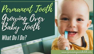 Permanent Tooth Growing Over Baby Tooth – What Do I Do