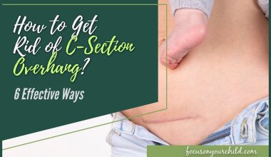 How to Get Rid of C-Section Overhang 6 Effective Ways