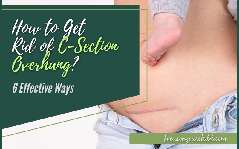 How to Get Rid of C-Section Overhang 6 Effective Ways