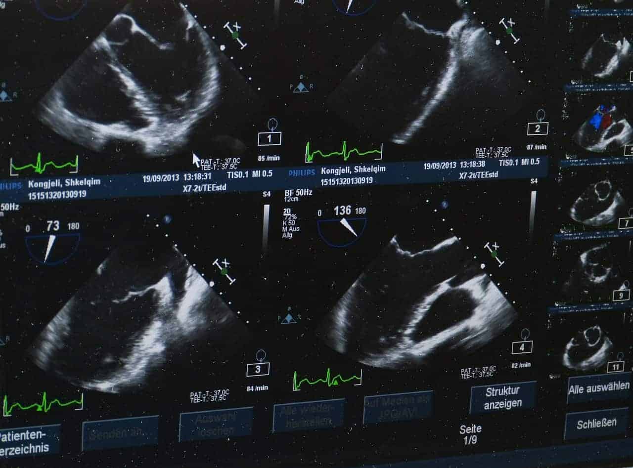 monitor close up ultrasound