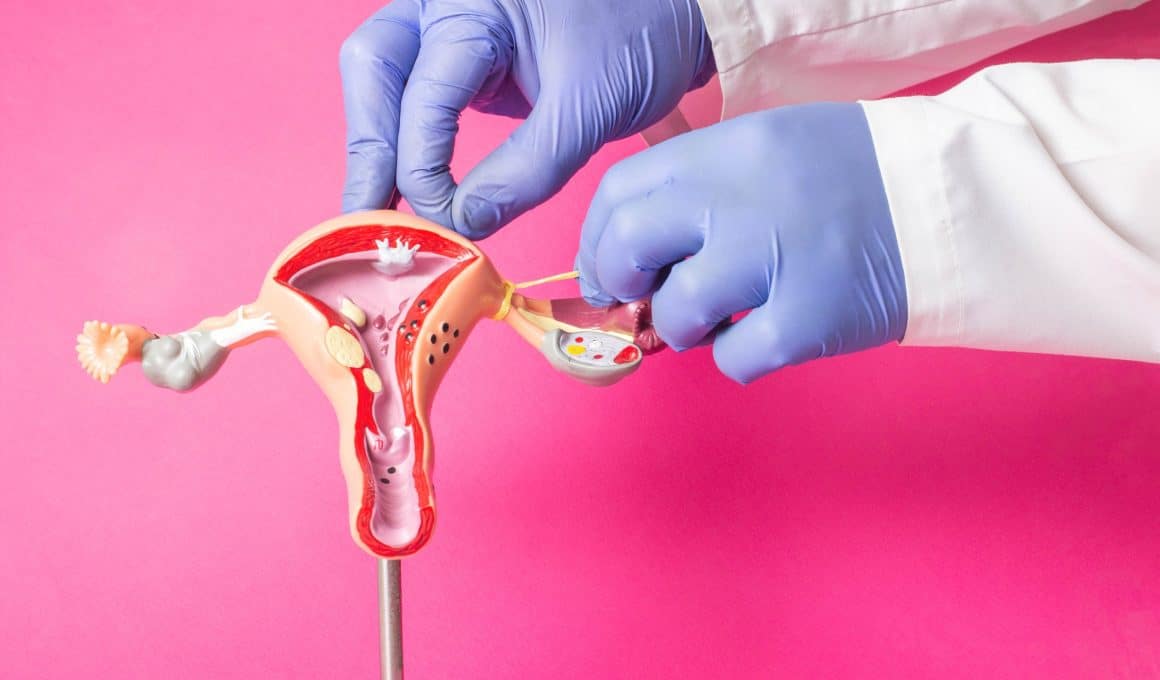 gynecologist demonstrating tubal ligatiion