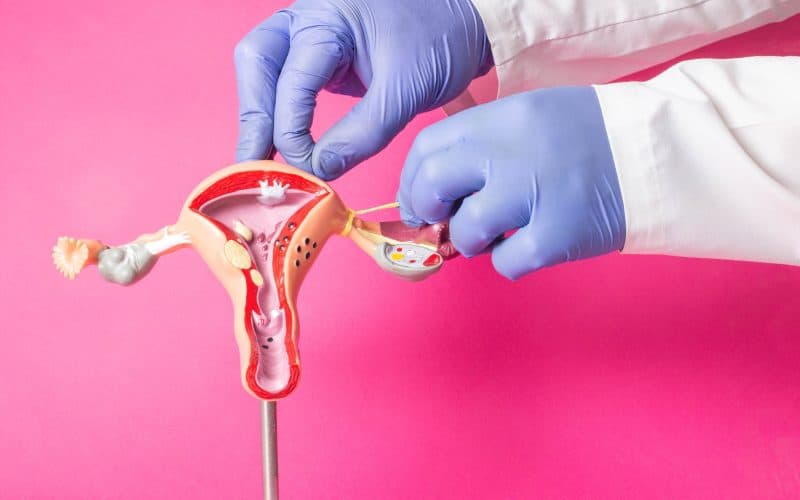 gynecologist demonstrating tubal ligatiion